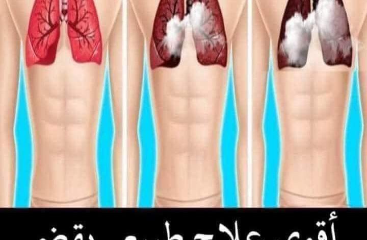 ازاي تنظف الرئة في خمس دقائق .. أقوى وصفات لتنقية الرئة من السموم ومن آثار التدخين حتى لو استمريت بالتدخين photo ٢٠٢٢ ١٢ ٠١ ٠١ ٠٧ ٣٨ 720x470 - ازاي تنظف الرئة في خمس دقائق .. أقوى وصفات لتنقية الرئة من السموم ومن آثار التدخين حتى لو استمريت بالتدخين