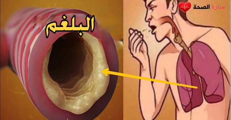 عندما تمتلئ رئتيك بالبلغم هذا افضل مشروب لطرد البلغم وعلاج البرد فى ساعات فقط photo ٢٠٢٢ ٠٤ ٠٣ ١٩ ٠٥ ٠٠ 780x405 1 - عندما تمتلئ رئتيك بالبلغم هذا افضل مشروب لطرد البلغم وعلاج البرد فى ساعات فقط