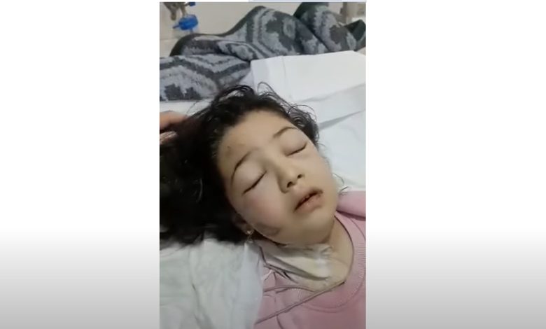 85 780x470 - فيديو مؤثر تقشعر لها الابدان لطفلة سورية بعد انتشالها تحت الانقاض وهي تقول “يا ربي صار لي كم يوم ما صليت”