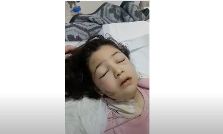 فيديو مؤثر تقشعر لها الابدان لطفلة سورية بعد انتشالها تحت الانقاض وهي تقول “يا ربي صار لي كم يوم ما صليت” 85 780x470 - فيديو مؤثر تقشعر لها الابدان لطفلة سورية بعد انتشالها تحت الانقاض وهي تقول “يا ربي صار لي كم يوم ما صليت”