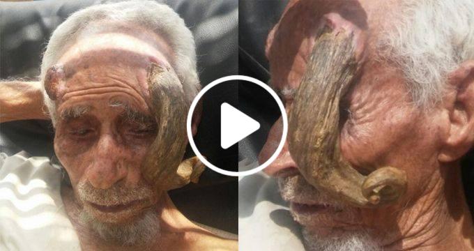 20621011 1992337604345375 1188042290609524280 n - شاهد بالفيديو رجل يمني كان له قرنان حقيقيان في رأسه وتوفي قبل ايام بسبب قرونه 140 عاما