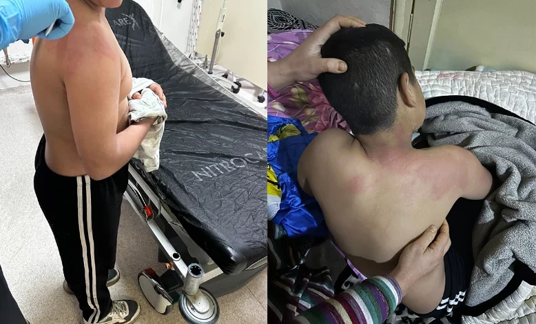 1 webp 778x470 - المعارضة التركية تفعل عمل صادم مع طفل سوري والحادثة تهز تركيا والسلطات تتحرك
