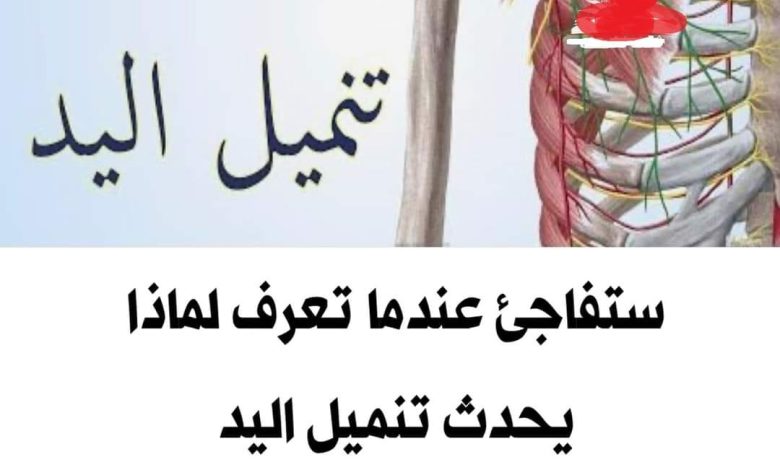 ماهي أسباب تنميل الاطراف وعلاجها ؟ 343760377 212996538121601 6867004351714847633 n 780x470 - ماهي أسباب تنميل الاطراف وعلاجها ؟