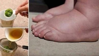 290149676 566286958464623 4273837771323206020 n 390x220 - طريقة بسيطة للتخلص من احتباس الماء في الجسم الذي يُسبب زيادة الوزن والمظهر السئ للجلد !!