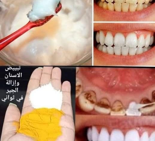 5 طرق طبيعية تحدث معجزة في تبييض الأشنان وإزالة الجير في ثواني 291797850 399715788856585 927007033417883115 n 518x470 - 5 طرق طبيعية تحدث معجزة في تبييض الأشنان وإزالة الجير في ثواني