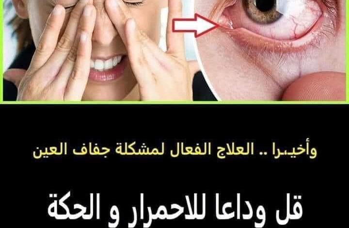 علاج حكة العين بطرق طبيعية تغنيك عن زيارة الطبيب 347276647 237536072465552 2831787278125965482 n 720x470 - علاج حكة العين بطرق طبيعية تغنيك عن زيارة الطبيب