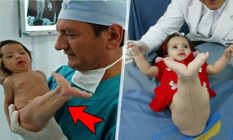 سخروا من هذه الطفلة لأنها ولدت تشبه حـورية البحر..بعد 5 سنوات ستندهش كيف أصبحت!!فيديو 369508309 9990518751020927 7719911469484016849 n 780x470 - سخروا من هذه الطفلة لأنها ولدت تشبه حـورية البحر..بعد 5 سنوات ستندهش كيف أصبحت!!فيديو