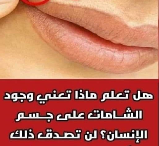هل تعلم ماذا تعني وجود الشـامات على جــسـم الإنسان؟ لن تصــدق ذلك أبدا مفاجاة مذهلة 378464948 122130289736007436 8344968651884277919 n 514x470 - هل تعلم ماذا تعني وجود الشـامات على جــسـم الإنسان؟ لن تصــدق ذلك أبدا مفاجاة مذهلة