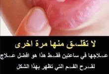 383390705 1047962163057781 1921029925785889119 n 220x150 - هناك علامة “غير عادية” تظهر في أصابعك قد تدل على سرطان الرئة